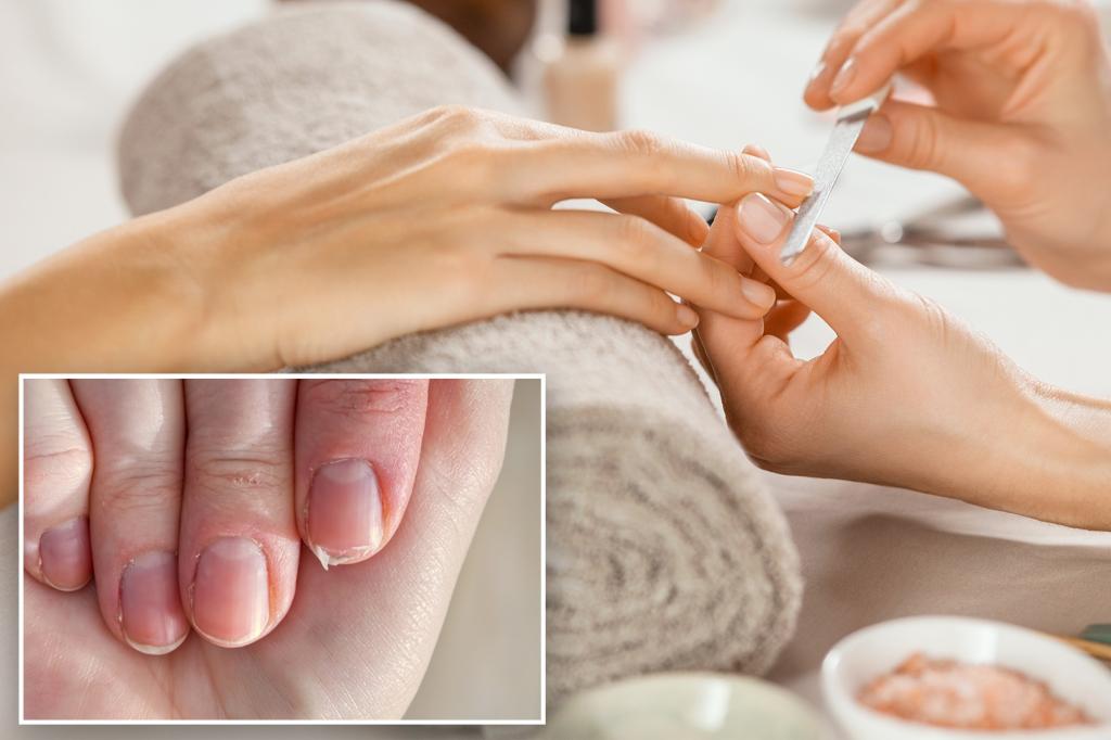 Exclusive | How to Make Your Weak and Brittle Nails Grow Stronger - and Nail Polish Mistakes Hurt