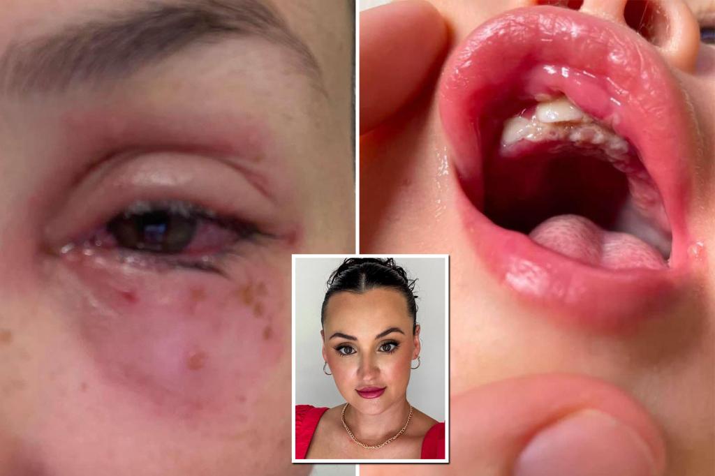 'Common' nursery illness almost cost mum her eye after viral infection: 'Sick inside and out'