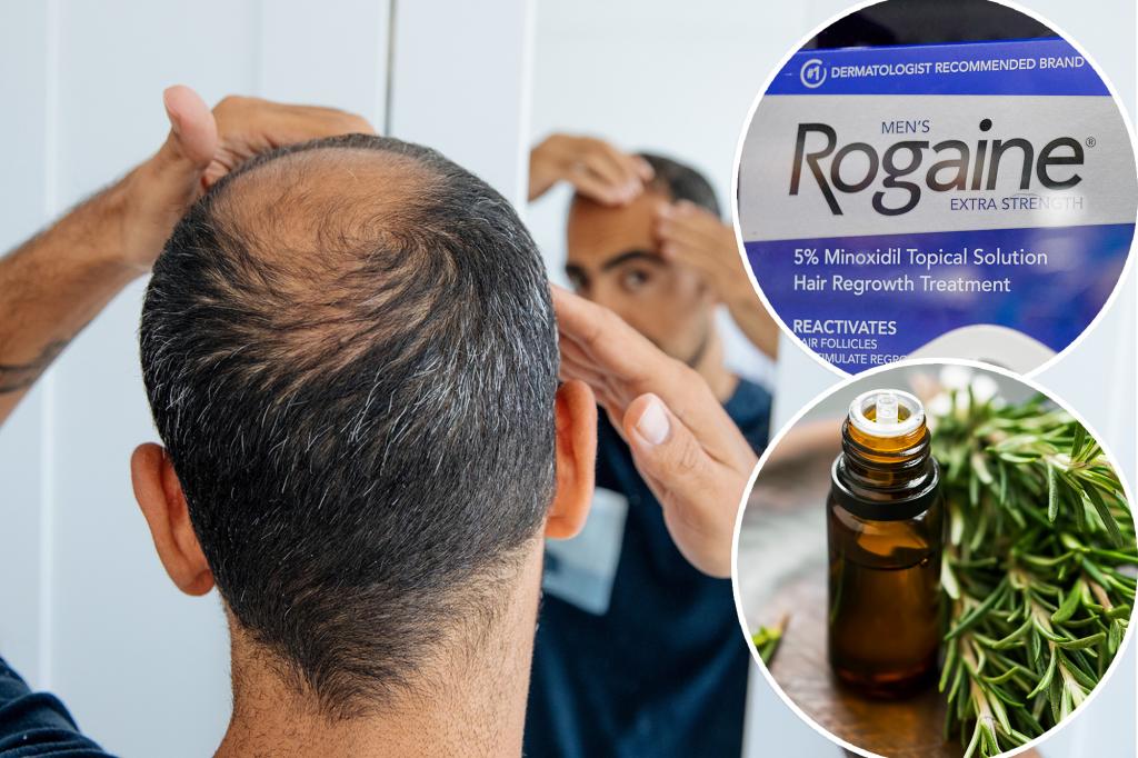 Rogaine and rosemary oil both fight hair loss - is it better when you use them together?