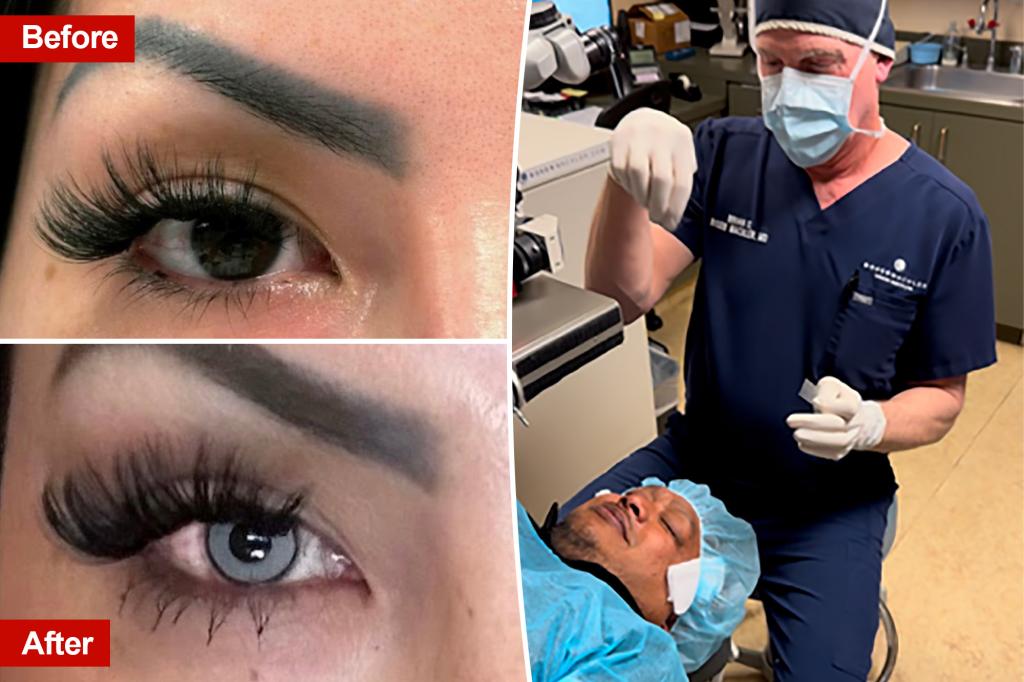 Doctor loads $ 6k for eye to change eye color forever: 'This is more scary than any horror movie'