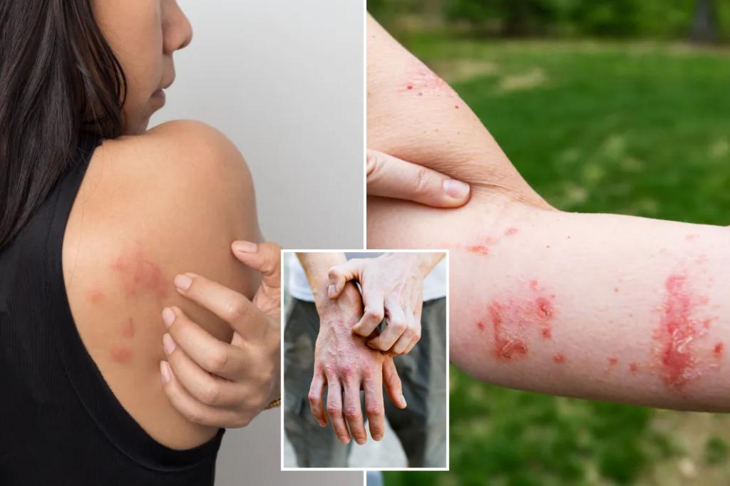 You don't have to scratch a itching rash - but the new study reveals that there are some benefits