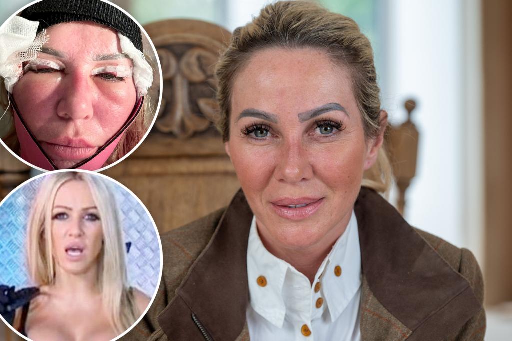 The former Playboy model changes $ 110K to cosmetic surgery at 'nice age': 'I have bumps and bumps and I don't care'