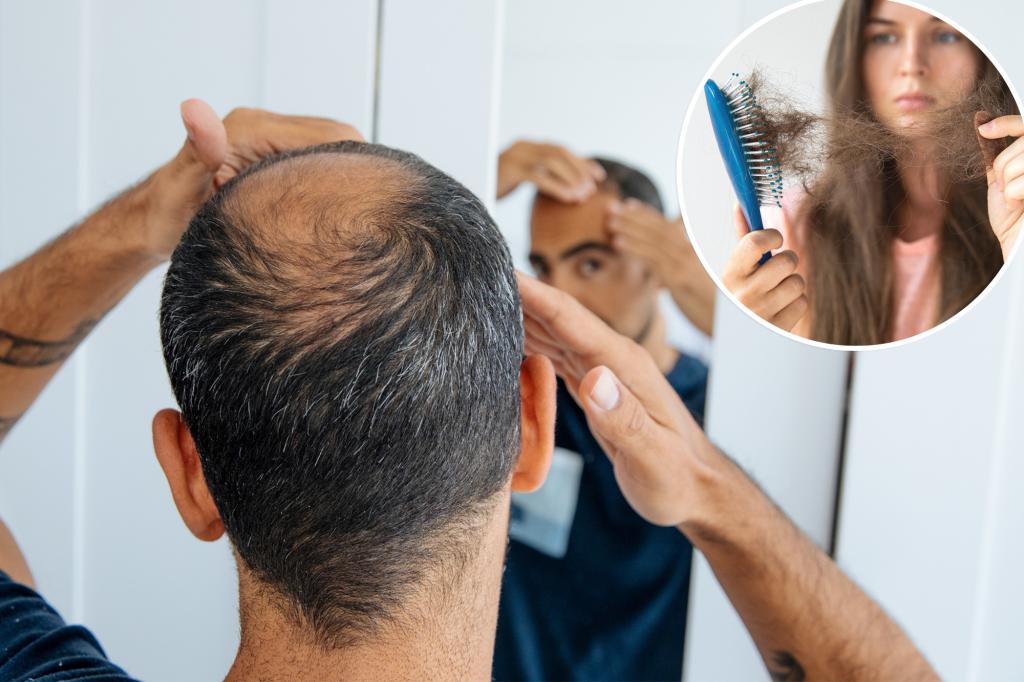 New hair loss treatment shows promises - paid volunteers needed to try it