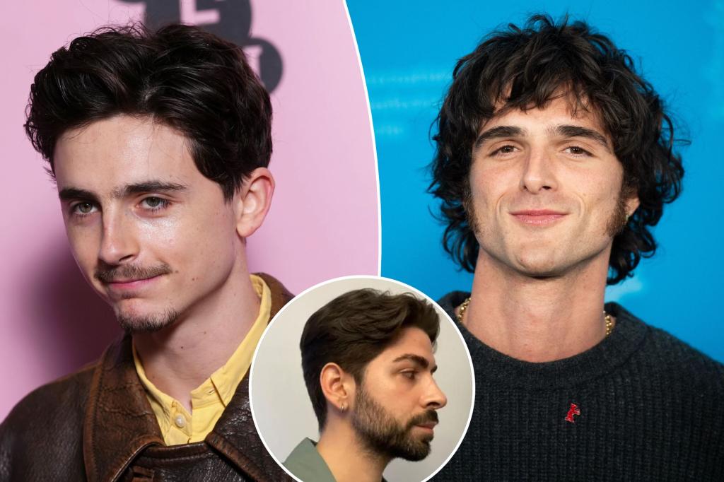 Exclusive | Men are injecting their jaws with good fillers to get timothye chalamet chisel-only to rule the board room: no 'old boy in the office'