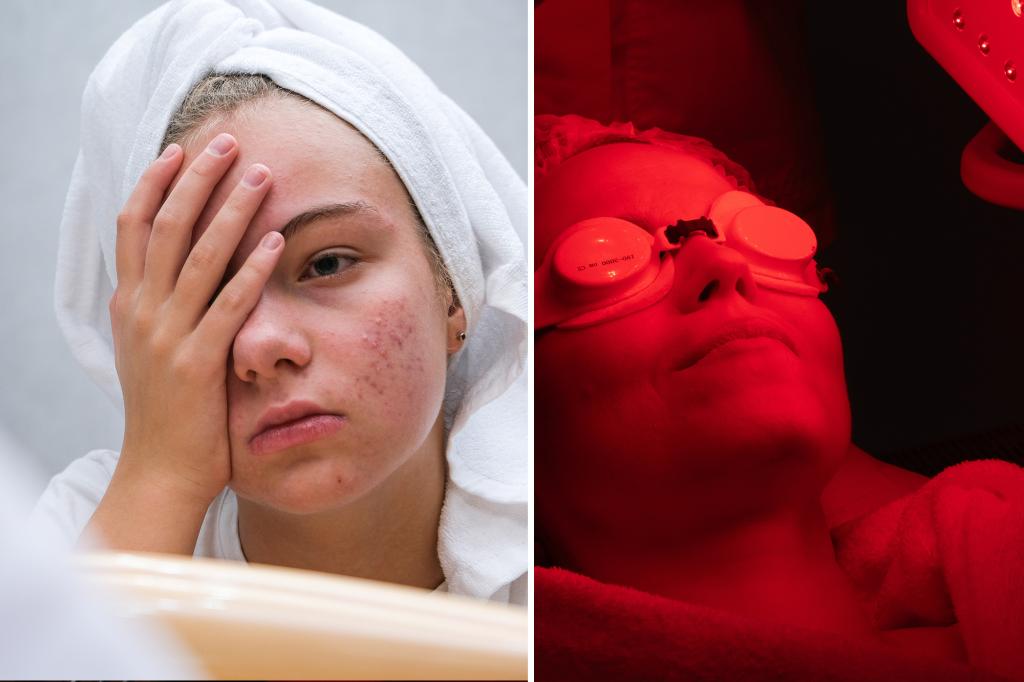 Can red light therapy really cure at home? New study tests led equipment